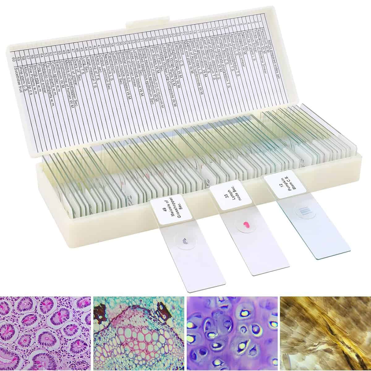 A collection of 25 microscope slides in a labeled plastic case, each with different specimens. Below, five sample slides show various tissue and cell structures in different colors under a microscope.